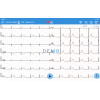 Électrocardiographe Edan SE-1200 Pro