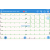 Électrocardiographe Edan SE-1200 Pro