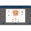 Électrocardiographe Edan SE-1200 Pro