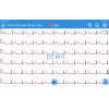 Électrocardiographe Edan SE-1200 Pro