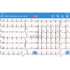 Électrocardiographe Edan SE-1200 Pro