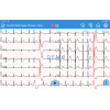 Électrocardiographe Edan SE-1200 Pro