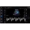 ECHOGRAPHE COULEUR PORTABLE EDAN NANO CONVEXE