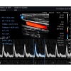 ECHOGRAPHE COULEUR PORTABLE EDAN NANO LINÉAIRE AVEC TABLETTE ANDROID ET SACOCHE