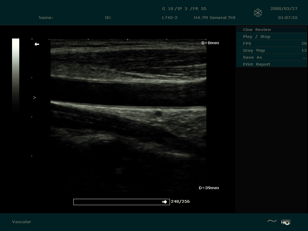 Index Of Transfer 00 Documentation 07 Edan Clinical Images Ultrasound Dus60 Others